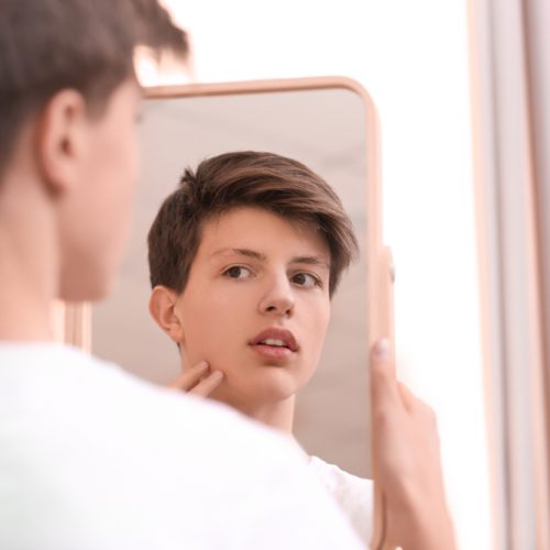Teenage,Boy,With,Acne,Problem,Looking,In,Mirror,At,Home